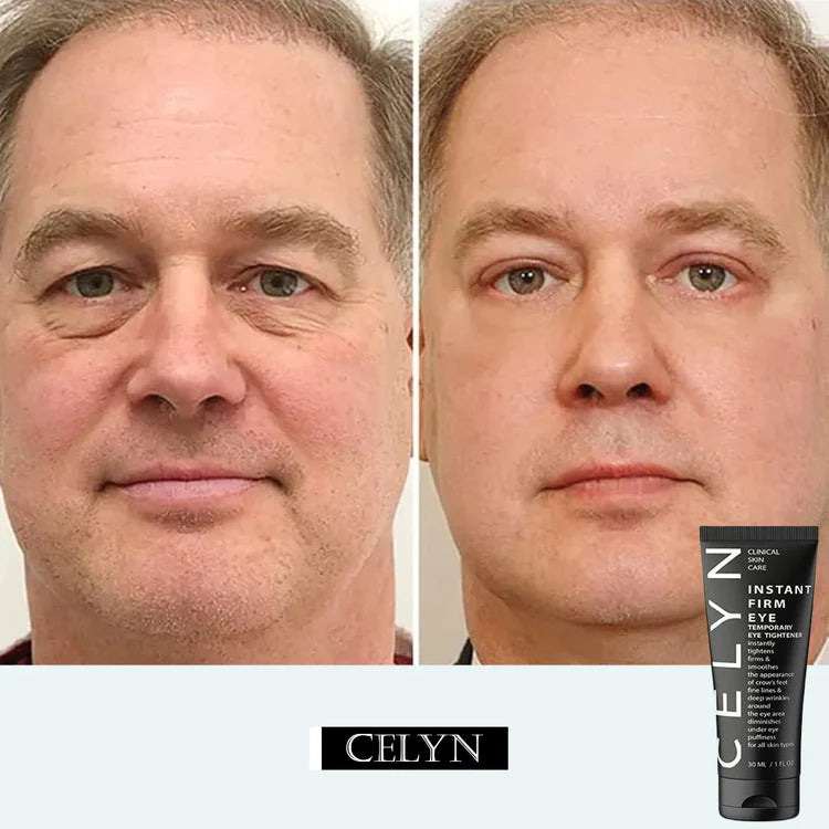 CELYN: Youthful Gaze Eye Cream