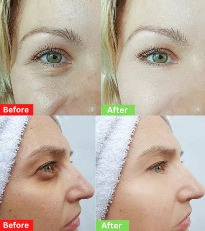 CELYN: Youthful Gaze Eye Cream