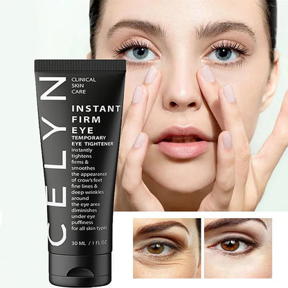 CELYN: Youthful Gaze Eye Cream
