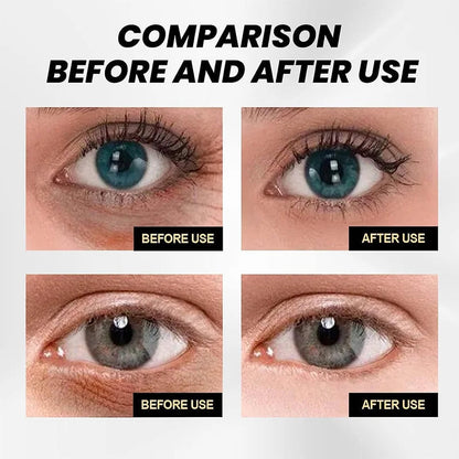 CELYN: Youthful Gaze Eye Cream