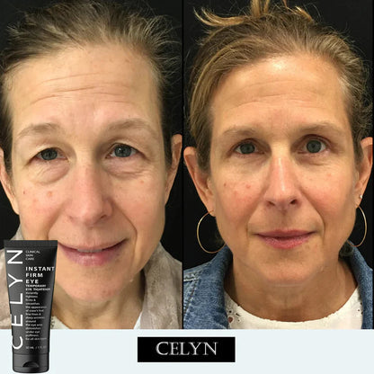 CELYN: Youthful Gaze Eye Cream